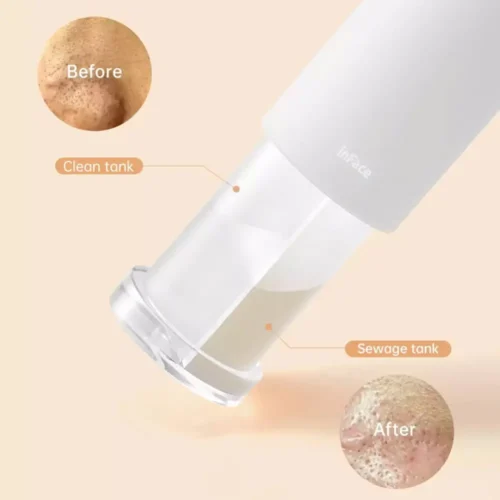 میکرودرم شیائومی InFace Thermal Aqua Peel CF-07E - Image 3